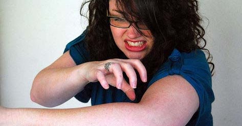 Que ungüento más vale aplicar a la psoriasis